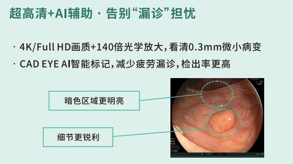 胃镜查了没事，一年后却查出胃癌？选对“高精度武器”有多重要
