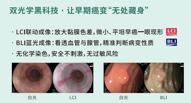胃镜查了没事，一年后却查出胃癌？选对“高精度武器”有多重要